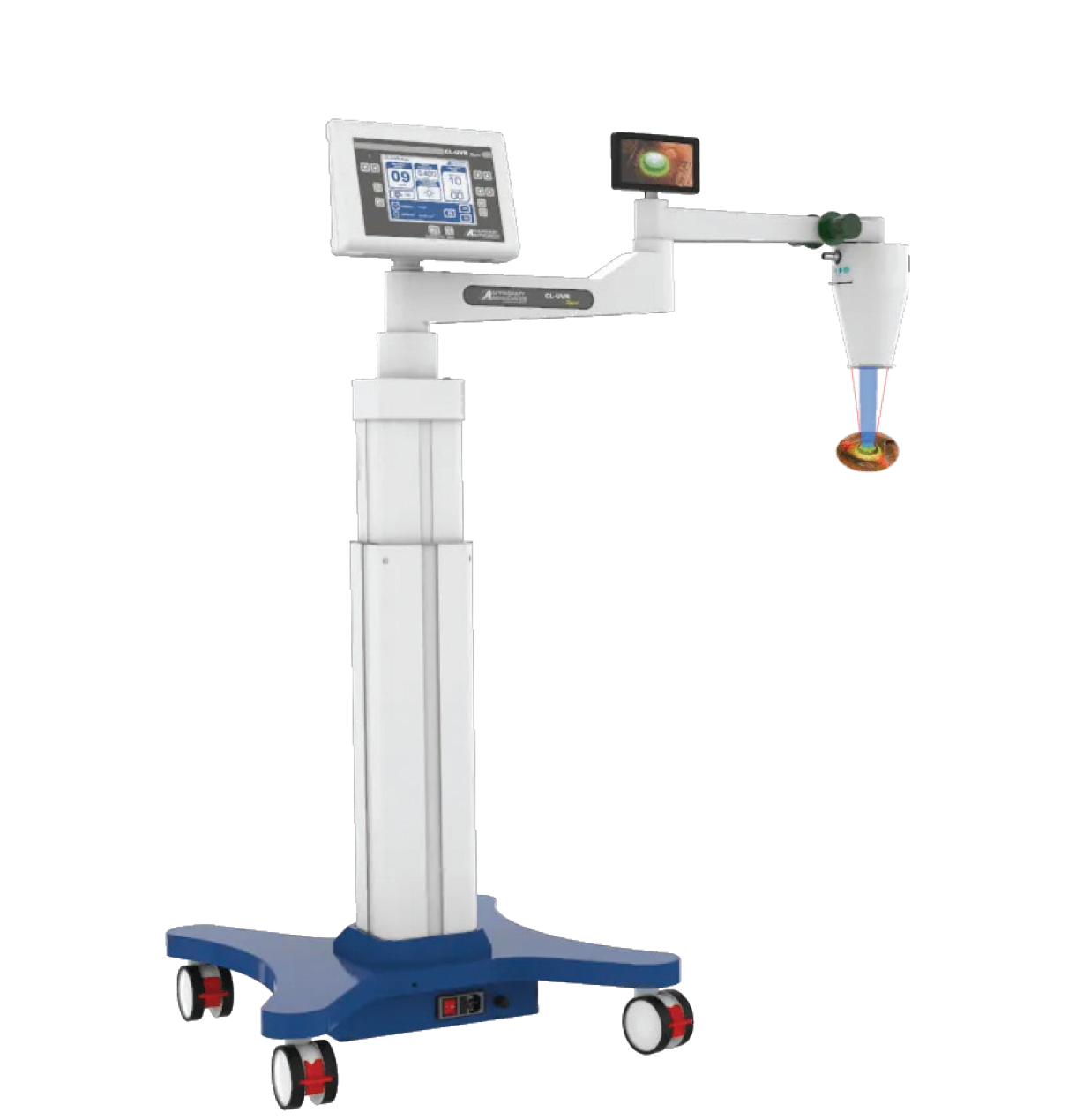 Corneal Cross -Linking (CL-UVR Rapid)