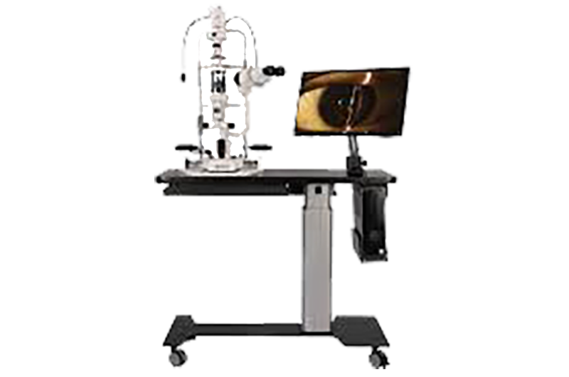 Slit Lamp Imaging (SL-CAM ICM-7)